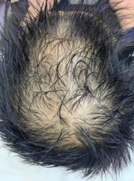 施術事例のBEFORE画像