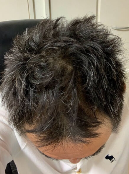 施術事例のAFTER画像